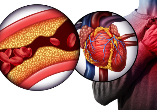 Understanding the Causes of Hypertension