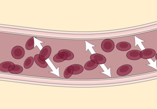 Understanding Hypertension: The Silent Killer