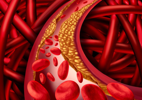 Understanding the Main Causes of Hypertension